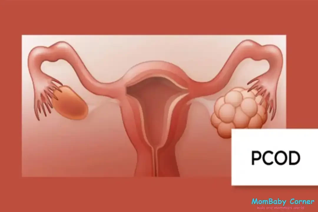 pcod disease in women